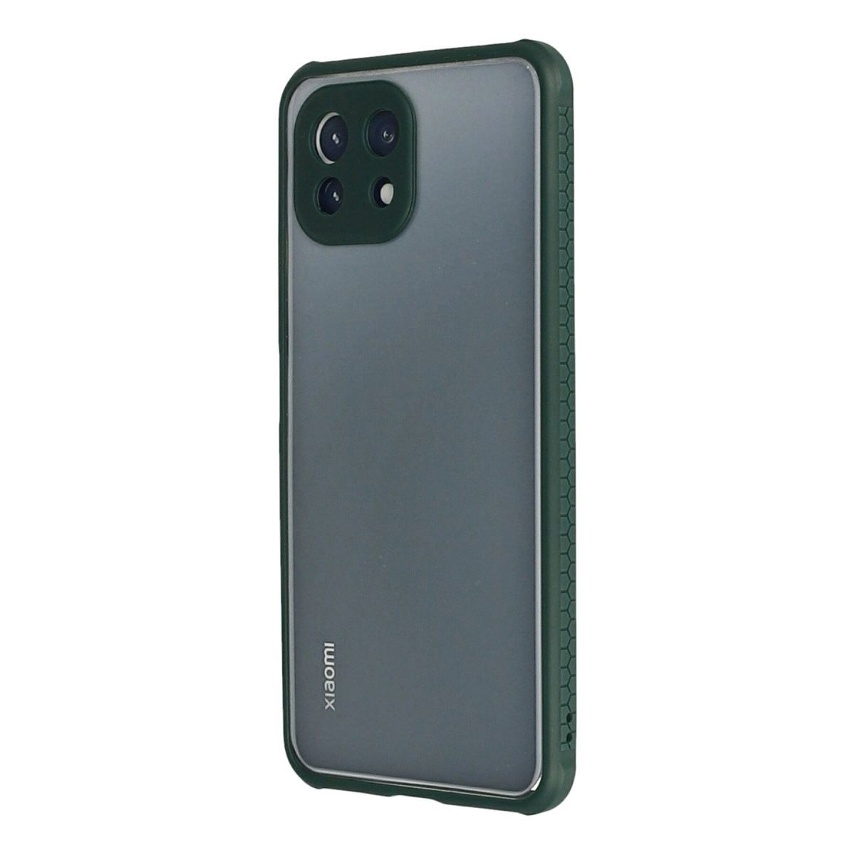 mdn-ark31698_xiaomi-mi-11-lite-kilif-miami-seffaf-silikon-koyu-yesil-3-46055459-sw1200sh1200-45qj6fqb.jpg Xiaomi Mi 11 Lite Kılıf Miami Şeffaf Silikon - Koyu Yeşil